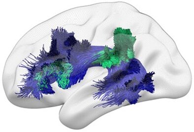 brain